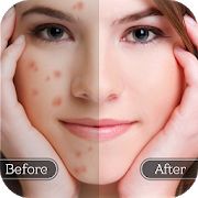 Скачать Средство для удаления пятен лица - гладкая кожа [Без Рекламы] на Андроид - Версия 1.4 apk